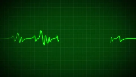 Heart Beat Pulse animated video, medical concept Stock-Footage 259616001