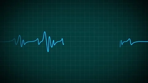 Heart Beat Pulse animated video, medical concept Видео 259616002