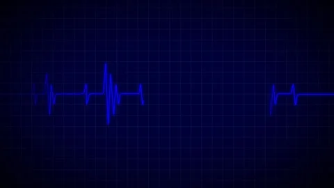 Heart Beat Pulse animated video, medical concept Vídeo Stock 259616004