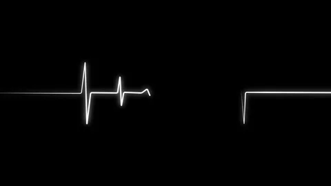 Heart Beat Pulse animated video, medical concept Vídeo Stock 259616005