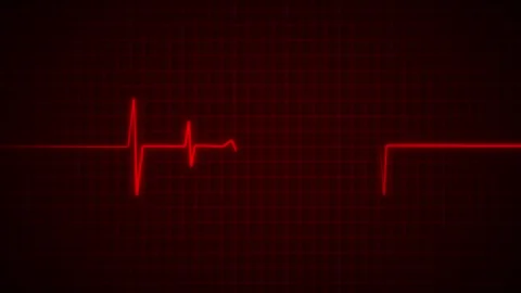 Heart Beat Pulse animated video, medical concept Vídeo Stock 259616007