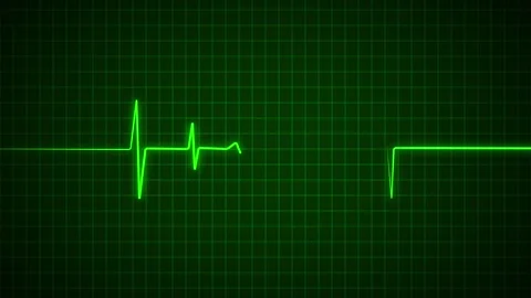 Heart Beat Pulse animated video, medical concept Vídeo Stock 259616012