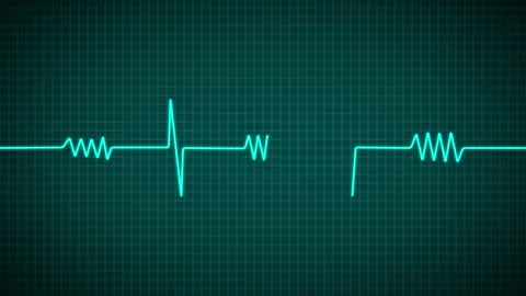 Heart Beat Pulse animated video, medical concept 库存影片 259616031