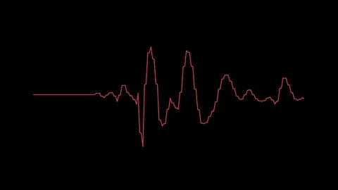 Heart beat pulse Stock Footage 94709012