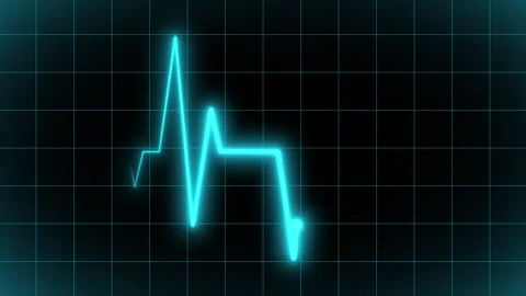Heart Beat Pulse Line Animation Video stock 345973388