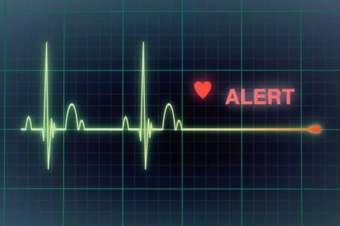 Heart beats cardiogram on the monitor. Stock Photos