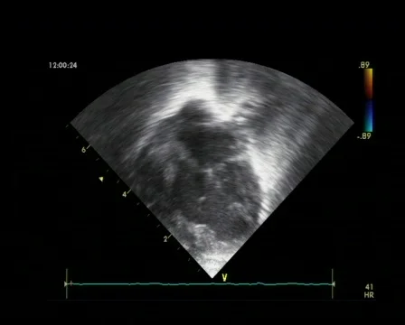 Heart beats 스톡 동영상 80595