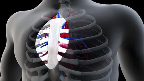 Heart Bypass Surgery | Stock Video | Pond5