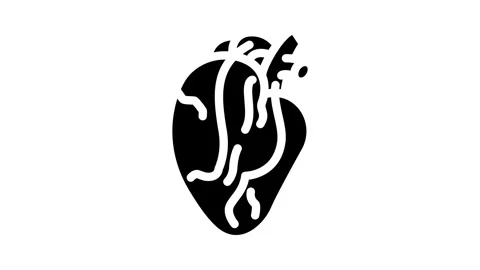 Heart bypass surgery glyph icon animation Stock Footage 326738100