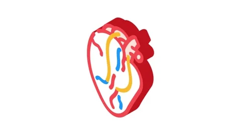 Heart bypass surgery isometric icon animation Stock Footage 327283027