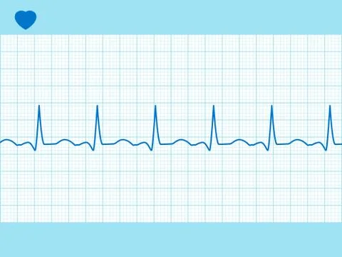 Heart cardiogram fully editable. EPS 8 Stock Illustration