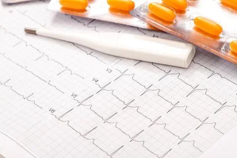 Heart care doing regular cardiogram check ups Stock Photos