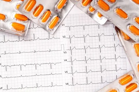 Heart care doing regular cardiogram check ups Stock Photos