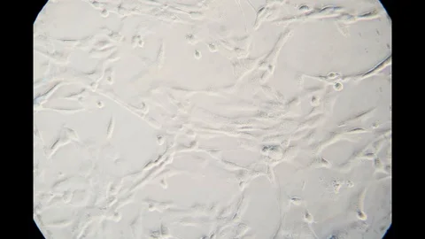 Heart Cells under a Microscrope 4k Video stock 125408879