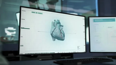Heart diagnostic system identifies a problem as a dangerous Cardiac Ischemia Stock Footage 256581891