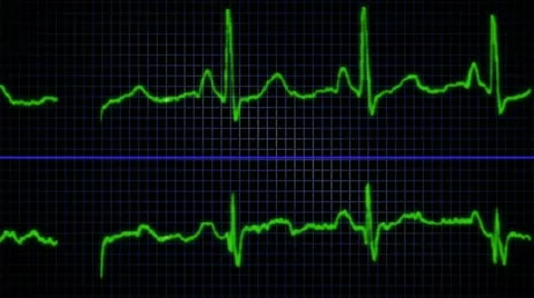Heart EKG Stock Footage 10912901