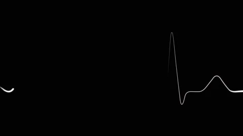 Heart electrocardiogram graph on black b... | Stock Video | Pond5