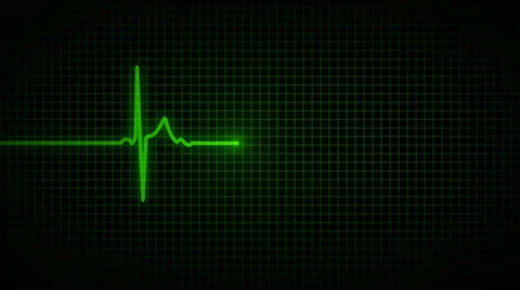 Heart line animation Stock Footage 37993598