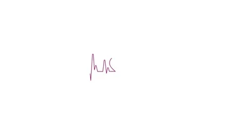 Heart line animation on white background 動画素材 153489568