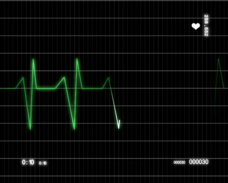 Heart line Stock Footage 626006