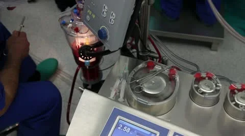 Heart lung bypass machine HD 1080p Stock Footage 10895739