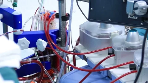 Heart lung machine for heart surgery Stock Footage 72405778