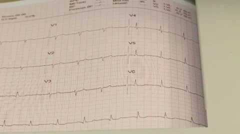 Heart pulse Vídeo Stock 10931530