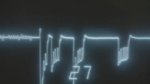 HEART RATE 1 Video stock 306761181