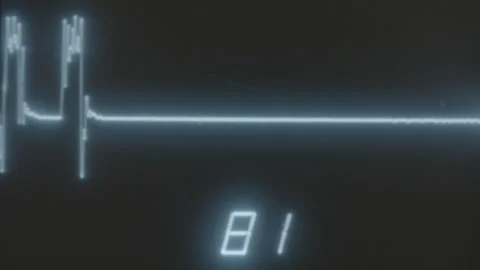 HEART RATE 2 Video stock 306761566