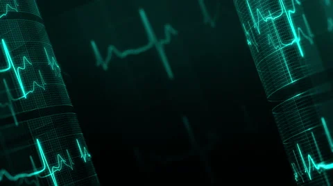 Heart rate, ECG. LOOP. Stock Footage 61802252