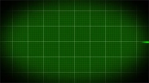 Heart rate Stock Footage 307723555