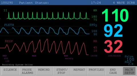 Heart Rate Monitor Stock After Effects