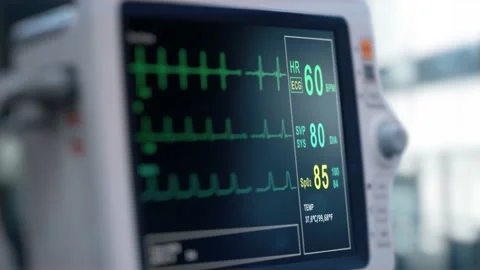 Heart rate monitor in hospital theater. Medical vital signs monitor instrument Stock Footage