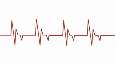 Animated Heart Rate Monitor Stock Footage ~ Royalty Free Stock Videos |  Pond5
