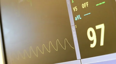 Heart rate monitors in surgery room and emergency room showing heartbeat Stock Footage 45294239