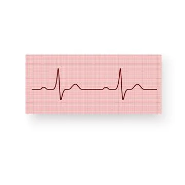 Heart Rate or a Heartbeat on a plotting paper. Cardiogram of the heart Stock Illustration
