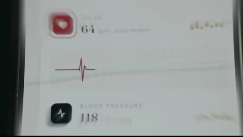 Heart rate reading, ECG trace showing a consistent waveform pattern Stock Footage 335892736