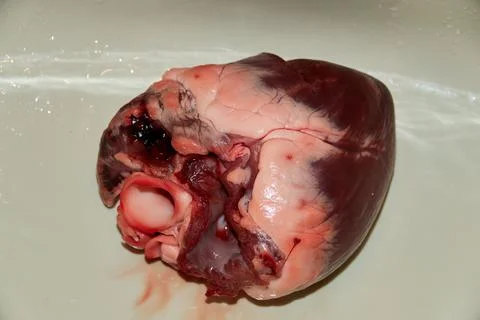 Heart ready for operation Stock Photos