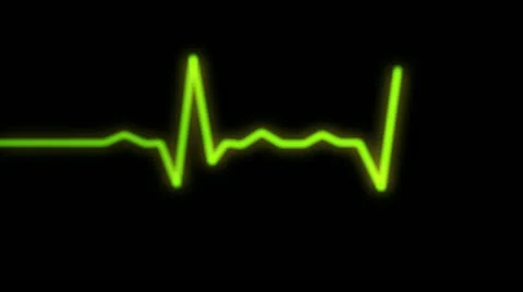 Heart rythm wave recorded on the ecg monitor in green color Stock Footage 10853362