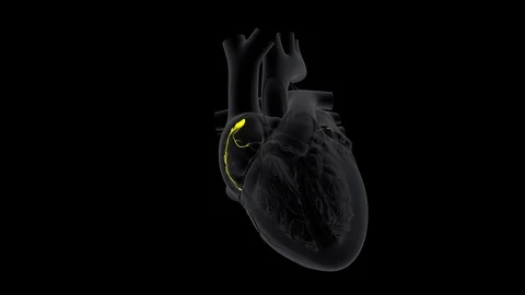 Heart SA NODE SIGNALS-SLOW BLACK Stock-Footage 125065533