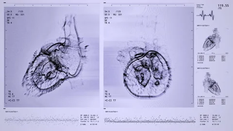 Heart scan front, side view animation. D... | Stock Video | Pond5