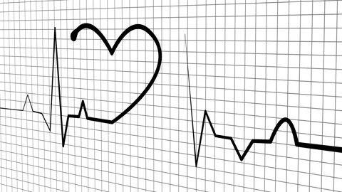 Heart-Shaped Electrocardiogram Line on Graph Paper Animation, A stylized el.. Stock Footage 305165953