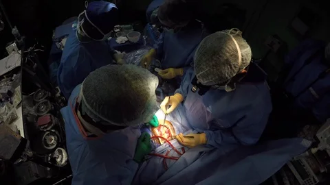 Heart surgeons performing open heart surgery (beating heart) Vídeos de archivo 120844816