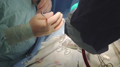 Heart surgery. Close-up. Hands of doctors in the frame. Video stock 149770655