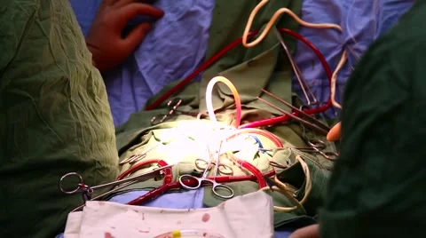 Heart surgery Video stock 957375