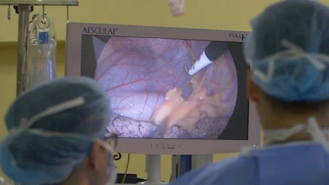 Heart surgery Stock Footage 118899358