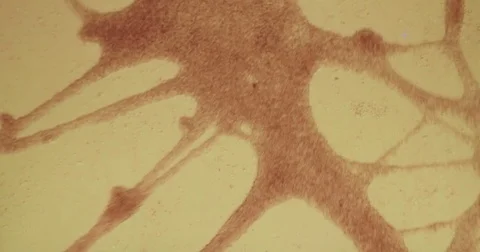 Heart tissue pulsating seen on a microscope  Stock-Footage 77282681