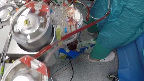 Heart transplant operation machinery and tools with blood flowing through Stock Footage