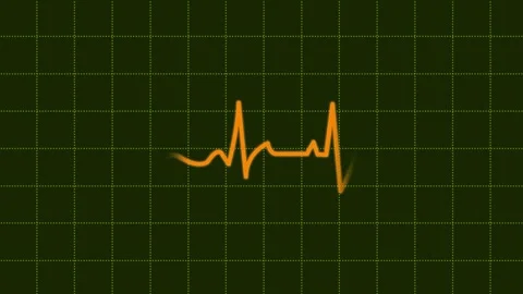 Heartbeat Background Dark Green Stock Footage 183353961