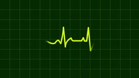 Heartbeat Background Green Stock Footage 183354335